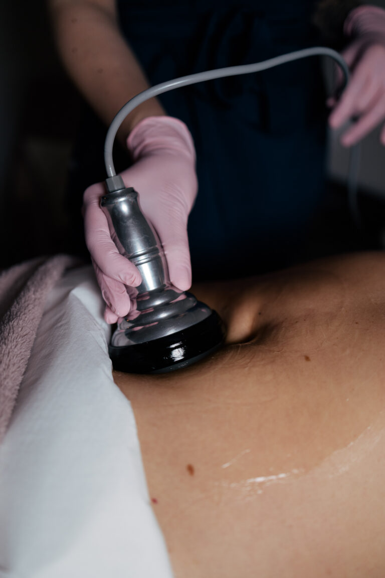 WYKORZYSTANIE LIPOSUKCJI W MODELOWANIU SYLWETKI